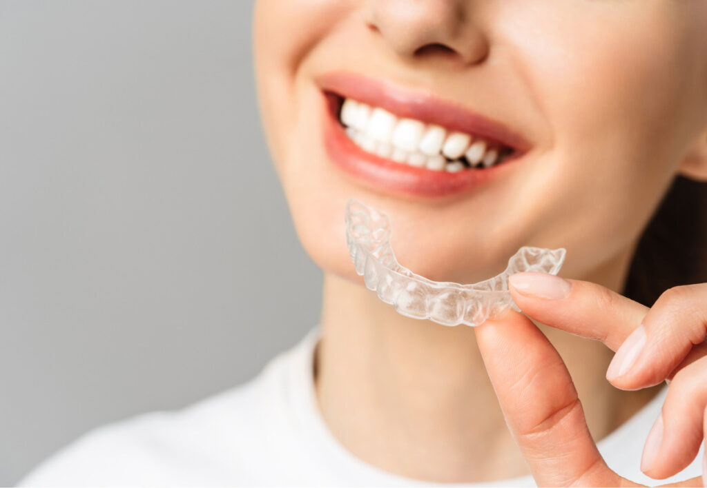 Ženska z Invisalign opornico prikazuje nevidni zobni aparat za poravnavo zob